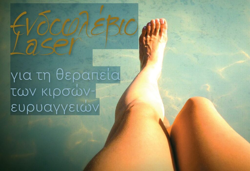 endoflevio-lazer|file1|file2