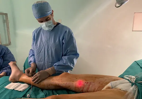 Φλεβική ανεπάρκεια