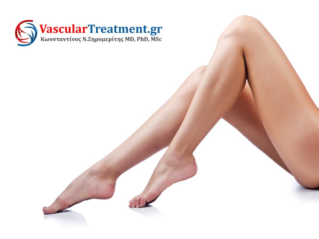 Ενδοαυλικό Laser και σκληροθεραπεία