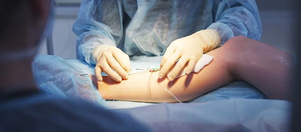 Φλεβικη ανεπαρκεια