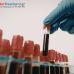 Σύγχρονες ενδοφλεβικές τεχνικές αντιμετώπισης κιρσών με laser και RFA