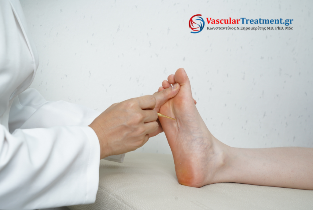 Διαβητικό πόδι συμπτώματα και έλεγχος